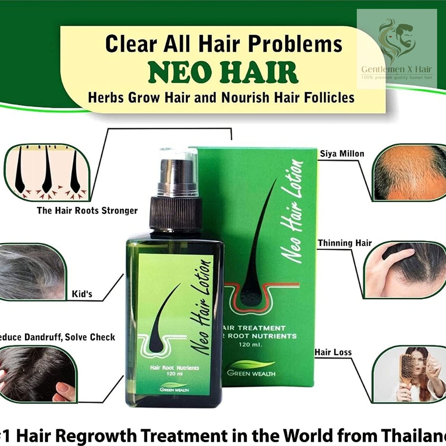 100% Original Made In Thailand Neo Hair Lotion with Derma Roller, Hair Treatment and Root Nutrients 120ml